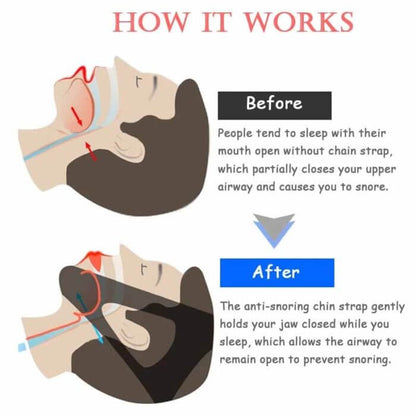 ANTI-SNORE CHIN STRAP - FlipinFit